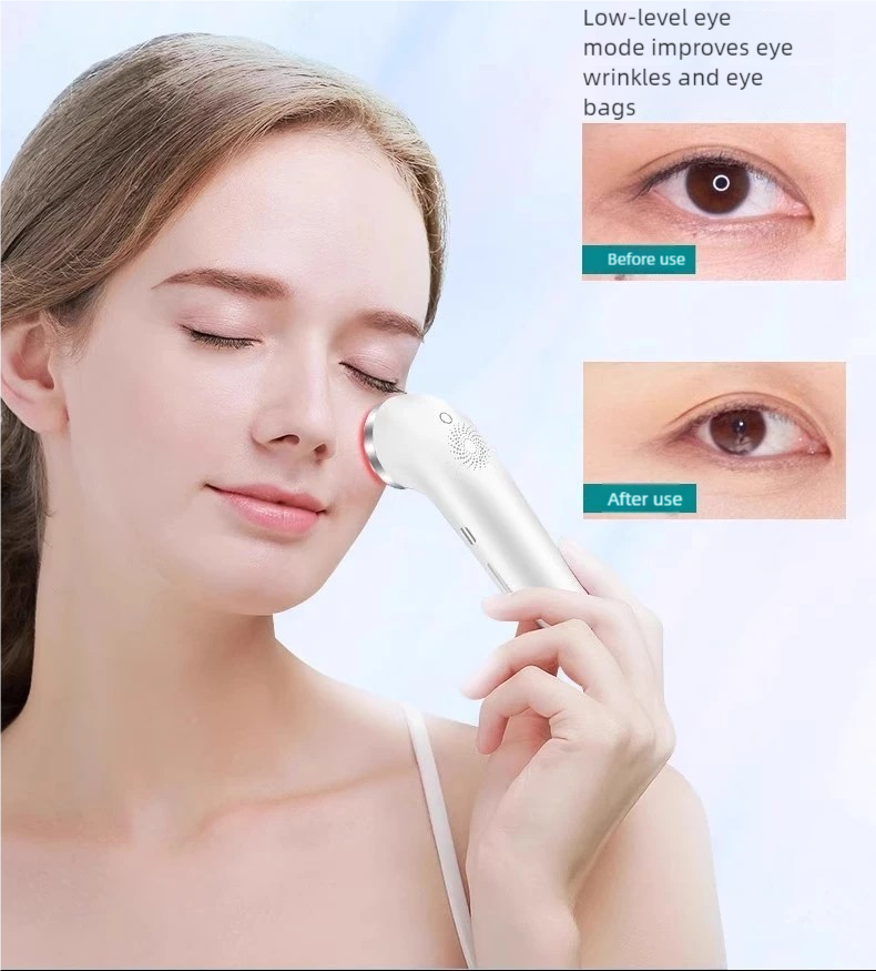 Skincare Hn - Multifunctional Radiofrequency Ultrasonic Beauty Device, Light-Based