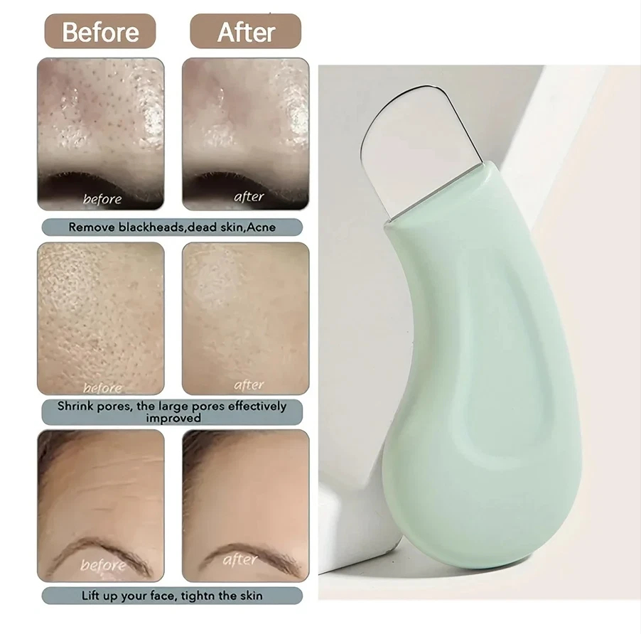 Professional Blackhead and Whi - Skincare Qv ulasan dan harga