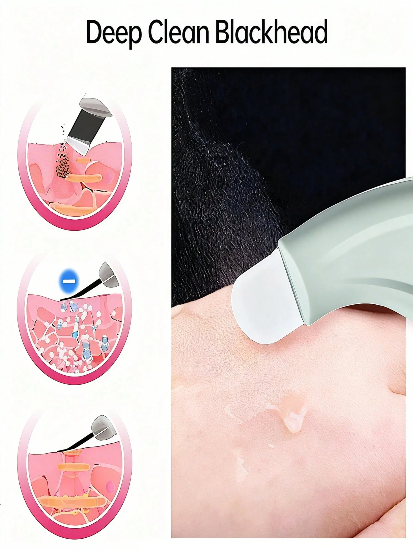 Professional Blackhead and Whi - Skincare Qv ulasan dan harga