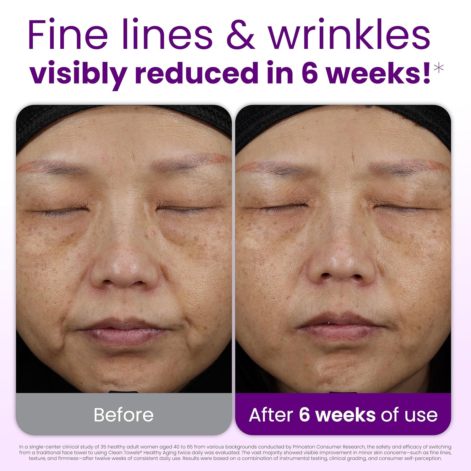 Reduce Fine Lines & Wrinkles i - Xl Skincare ulasan dan harga