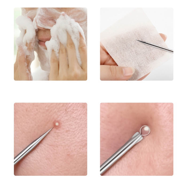 4pcs/set Acne Removal Needles  - Skincare Qv ulasan dan harga