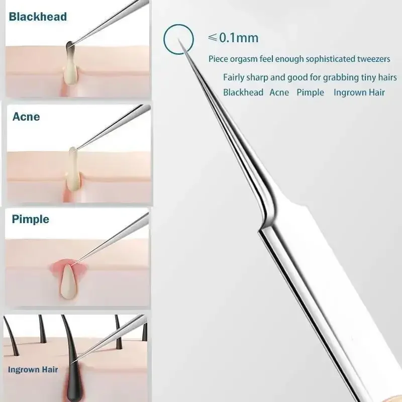 11Pcs/Set Acne Needle Blackhea - Skincare Qv ulasan dan harga