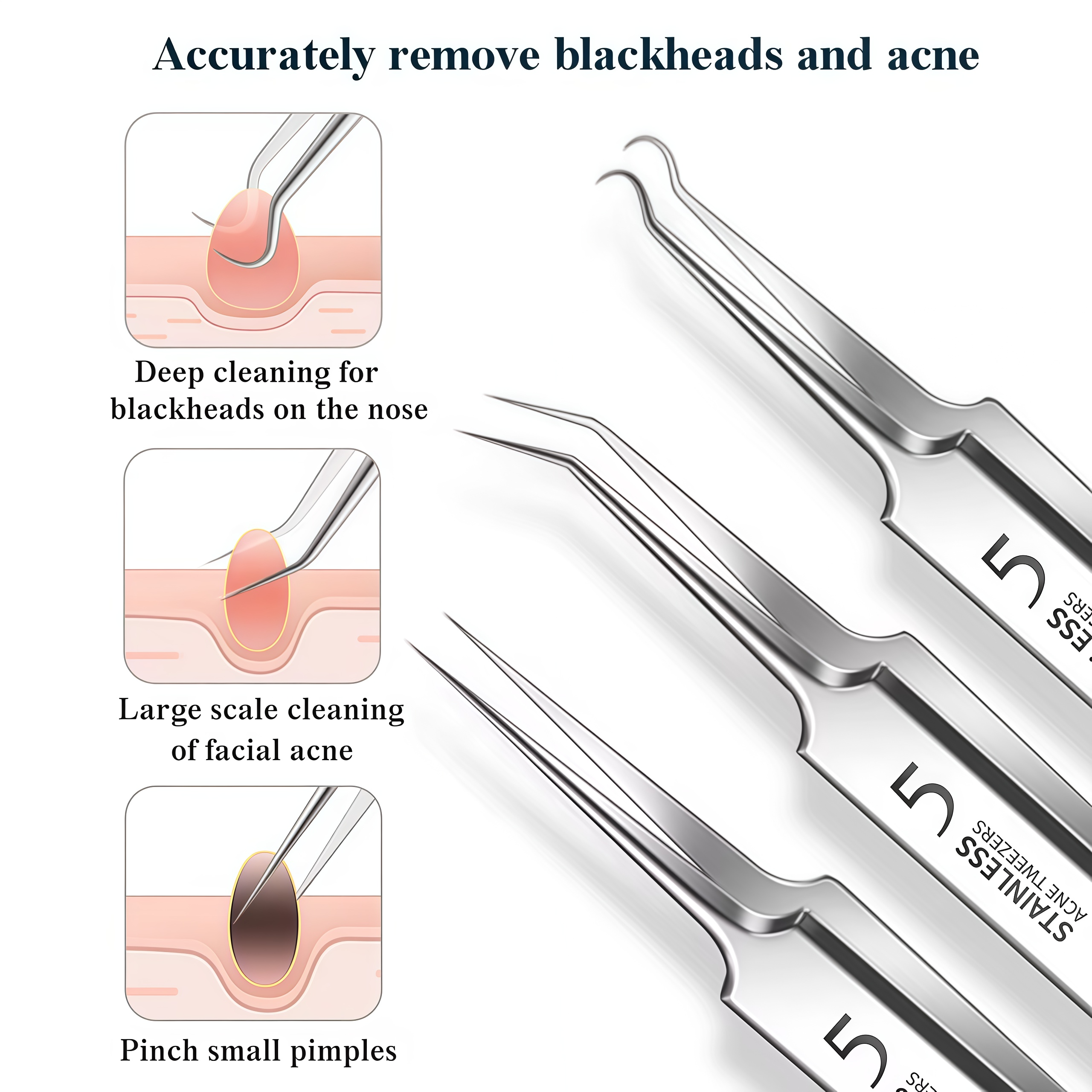4-11Pcs Ingrown Hair Tweezers  - Skincare Qv ulasan dan harga